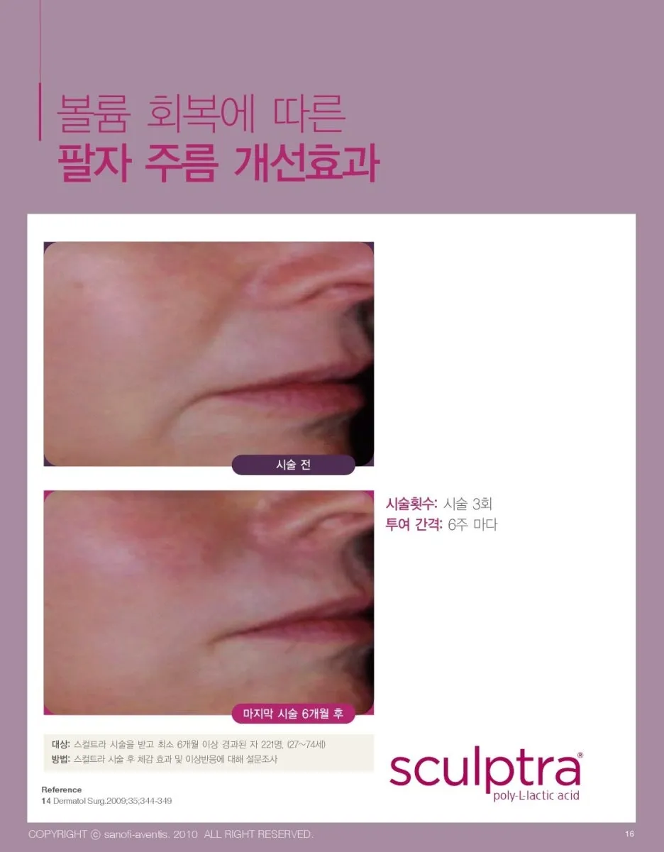 %EC%B5%9C%EC%A2%85%EC%8A%A4%EC%BB%AC%ED%8A%B8%EB%9D%BC%ED%99%98%EC%9E%90%EB%B6%81-17.jpg?type=w1