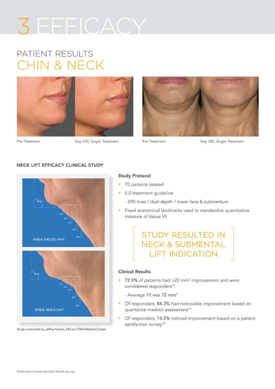 LR-Ulthera-Brochure-10.jpg?type=w1