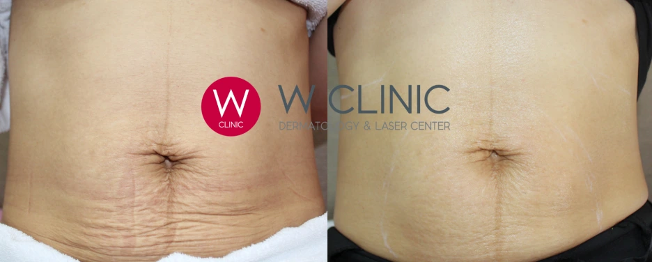 %EC%A0%9C%EB%AA%A9_%EC%97%86%EB%8A%94_%EB%94%94%EC%9E%90%EC%9D%B8_(1).png?type=w1