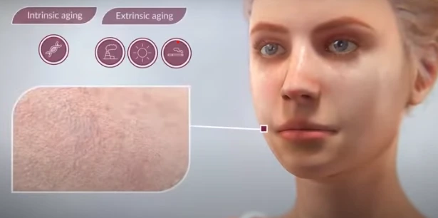 %ED%94%BC%EB%B6%80%EB%85%B8%ED%99%94.png?type=w1