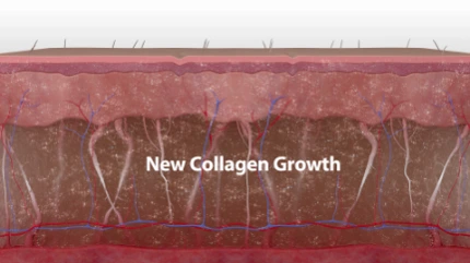 %EC%8D%A8%EB%A7%88%EC%A7%80_%EC%9B%90%EB%A6%AC3.png?type=w1