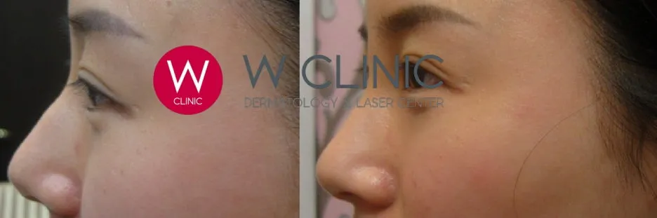 SE-b266c65f-f9c5-4281-98c7-968398f1bfdd.jpg?type=w1