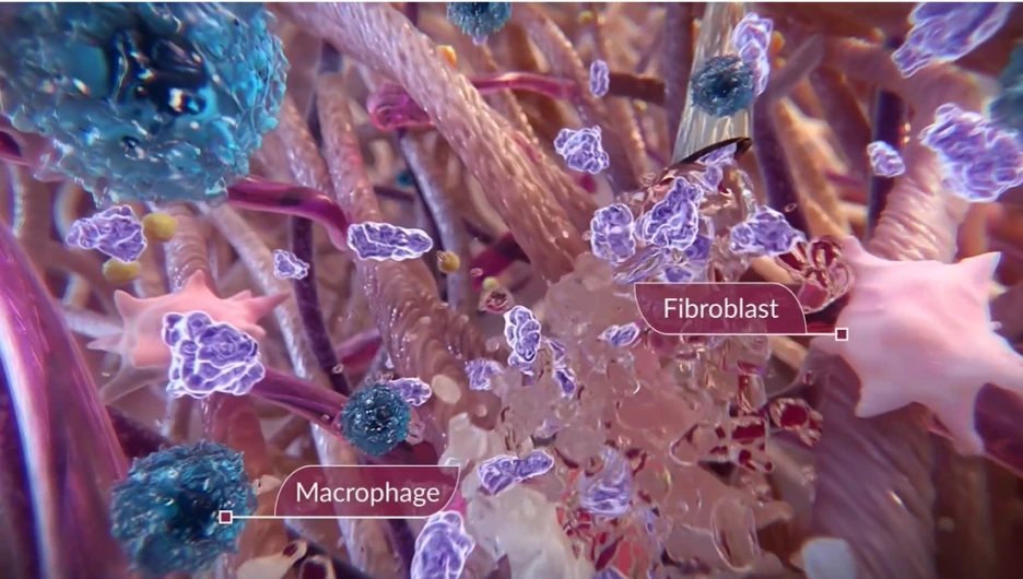 %EC%8A%A4%EC%BB%AC%ED%8A%B8%EB%9D%BC2.png?type=w1