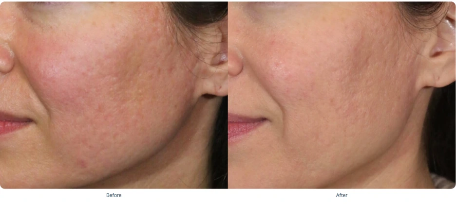 %EC%86%8C%ED%94%84%EC%9B%A8%EC%9D%B4%EB%B8%8C_%EC%A0%84%ED%9B%84_7.png?type=w1