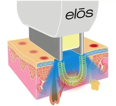 %EC%9D%B4%EB%A7%A5%EC%8A%A4%EC%A0%84%EA%B7%B9.jpg?type=w1