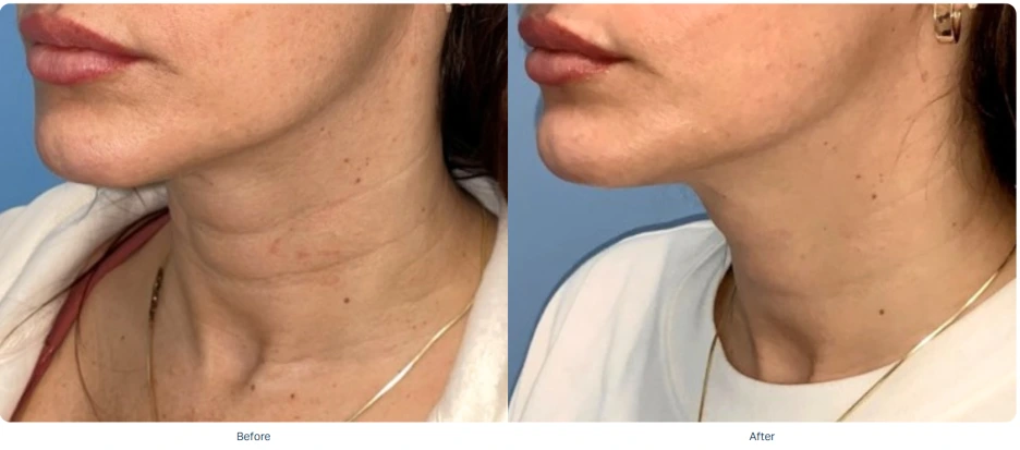 %EC%86%8C%ED%94%84%EC%9B%A8%EC%9D%B4%EB%B8%8C_%EC%A0%84%ED%9B%84_2.png?type=w1