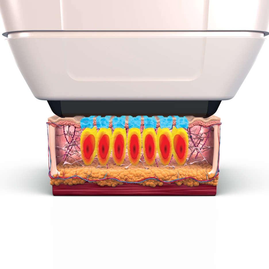 Sofwave_Print_02.png?type=w1