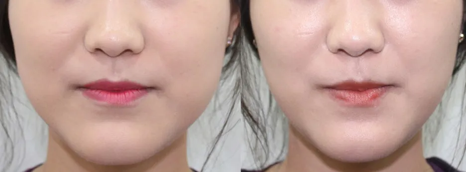 %EC%82%AC%EA%B0%81%ED%84%B1%EB%B3%B4%ED%86%A1%EC%8A%A4.jpg?type=w1