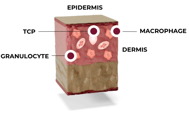 hcp-2.0-illustration-skin-stage1.png?type=w1