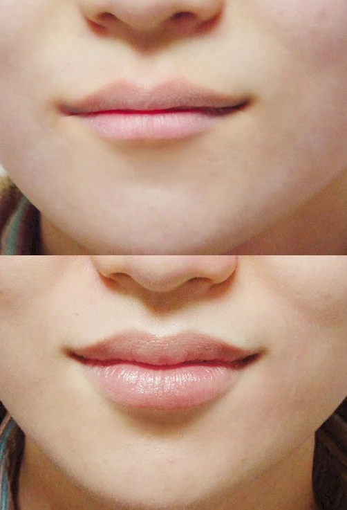 %EC%9E%85%EC%88%A0_BA3.jpg?type=w1