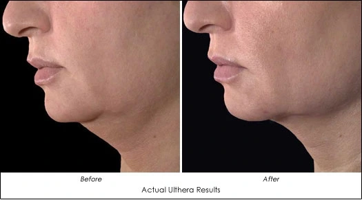 2011-06-14_16;45;38.jpg?type=w1