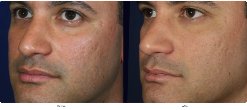 %EC%86%8C%ED%94%84%EC%9B%A8%EC%9D%B4%EB%B8%8C_%EC%A0%84%ED%9B%84_6.png?type=w1