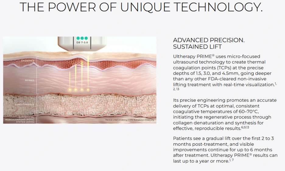 %EC%9A%B8%EC%8E%BC%EB%9D%BC_%EC%9B%90%EB%A6%AC_1.png?type=w1