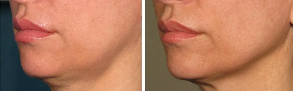 2012-03-03_AM_12-24-43.jpg?type=w1