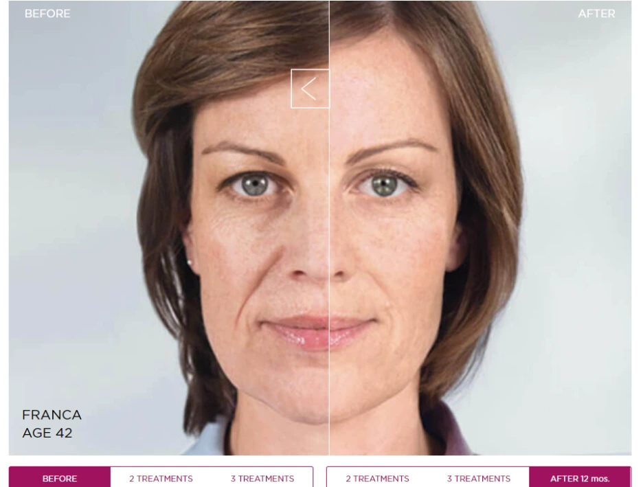 %EC%8A%A4%EC%BB%AC%ED%8A%B8%EB%9D%BC_%EC%A0%84%ED%9B%84_2.png?type=w1