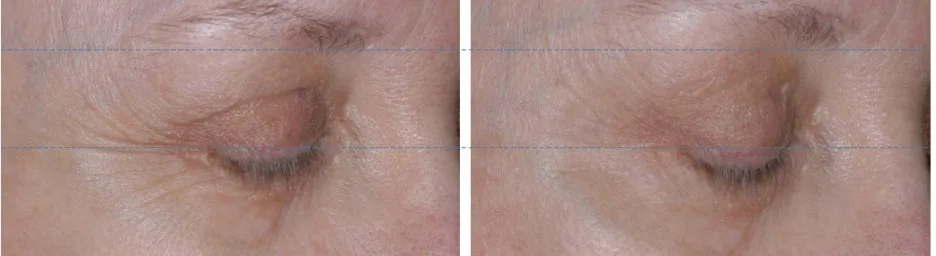 2012-03-03_AM_12-27-28.jpg?type=w1