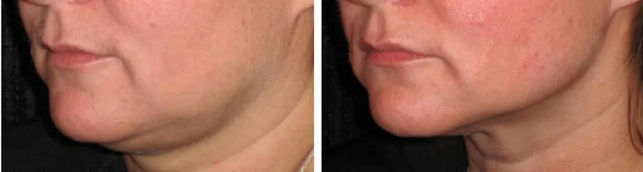 2012-03-03_AM_12-20-16.jpg?type=w1