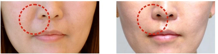 %EC%8A%A4%EC%BB%AC%ED%8A%B8%EB%9D%BC_%EC%A0%84%ED%9B%84%EC%82%AC%EC%A7%84.jpg?type=w1