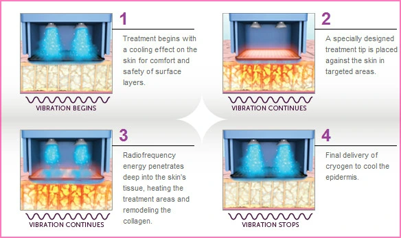 4d1b1f97de58866dacfa2814982a7190.png?type=w1