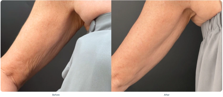 %EC%86%8C%ED%94%84%EC%9B%A8%EC%9D%B4%EB%B8%8C_%EC%A0%84%ED%9B%84_8.png?type=w1