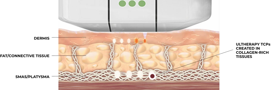 hcp-2.0-illustration-skin-layers.png?type=w1