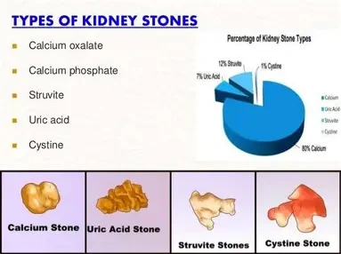 OIP.v1OFTpBpEsLw07QqykhY5gHaFj?pid=ImgDet&w=213&h=159.91692789968653&c=7&dpr=1.8&o=7&rm=3