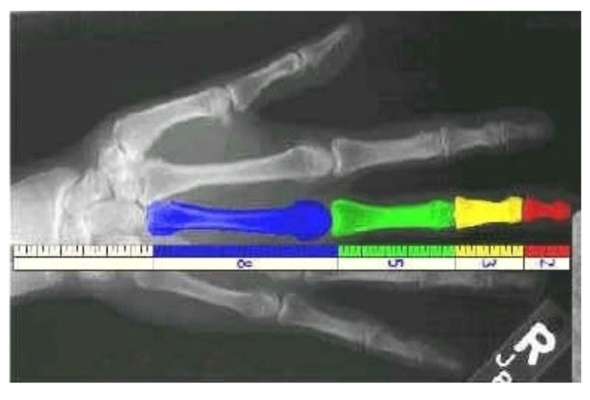 SE-20c0efaf-5474-11f0-921e-edde66fd9f19.jpg?type=w966