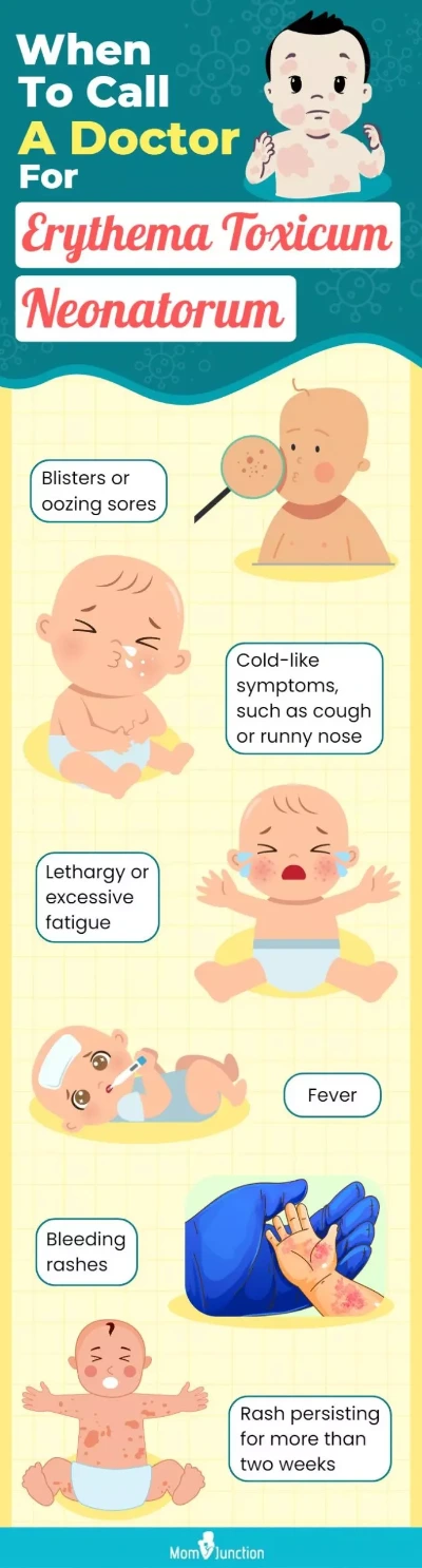 When-To-Call-A-Doctor-For-Erythema-Toxicum-Neonatorum-scaled.jpg.webp