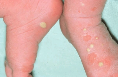 ET3.png?resize=560%2C367&ssl=1