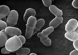 images?q=tbn:ANd9GcTowo_Elb4tSYIhXl_6ZtgZVr20xyxJeCHJDg&s