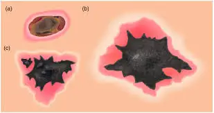 images?q=tbn:ANd9GcSTQjJsWTzKmOHJBBjlNYL7IEI0Wpe0VKfnyA&s