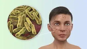 images?q=tbn:ANd9GcSx67moRI7xRIrslryH_EuUg8h7bavoFbhWDQ&s