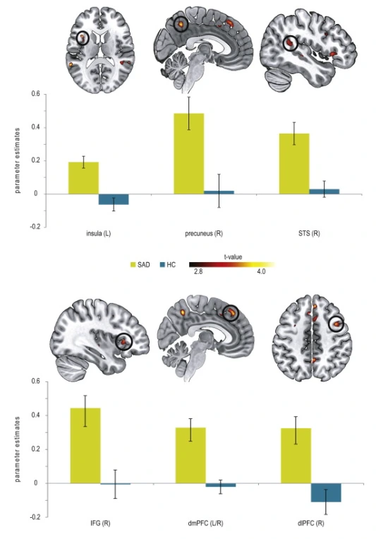 SE-97919ff6-4949-4049-ad15-4991e9acf1de.png?type=w966