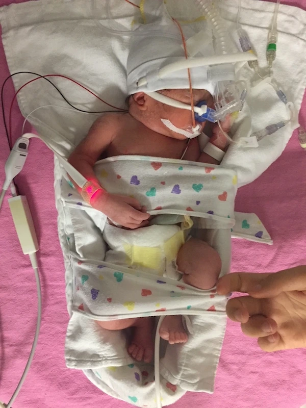 인큐베이터 사진 6.JPG