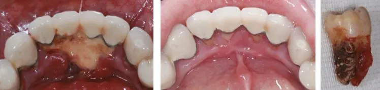 스케일링 전후.JPG