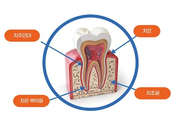 임플란트 -01.JPG