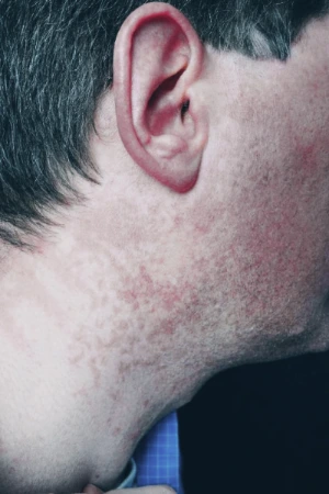 AD_4nXfaMiDZw0vCf29sC9xSiDygWdsxiXHtxLqoHSEhFpwMi6Jsg6p4HpSFInWqaC3fD_7-MgVwEIG1N_7EVSwGWkPOfy5zTHAdEaT_py307EE3VtfDj3GX-pmzl1VGfeQJlOqKeiqWEdbOhtHJavQtfmA8J0iBMt2G_od_n_TXl-gWTY2vAImgYA?key=bxChBuoWXcLnP0bpPLrnlg