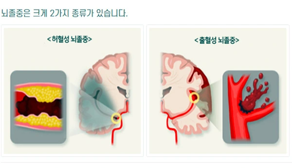 2Dcj3w1qfu58NdQJ5kpcX5XJIm4