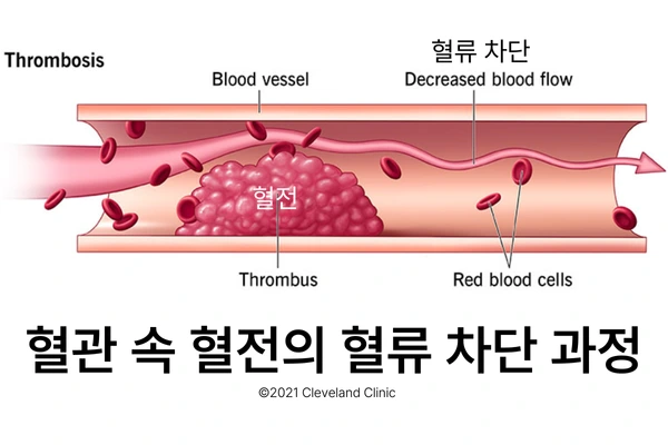 %EB%B8%94%EB%A1%9C%EA%B7%B8%EC%82%BD%EC%9E%85%EC%9D%B4%EB%AF%B8%EC%A7%802_202410.png?type=w1