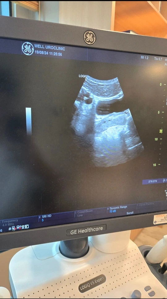 SE-21af43db-3138-4029-8cd2-760d2a2a7e59.jpg?type=w773