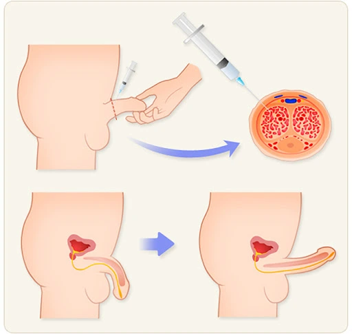 AD_4nXerPahC9l-O0pI4ULgSInffmFGNqaAcQfSEZMDPGIBybzynY6-SsSiDH7hiUU-j_rYalQh5nbI-ZRFUffT8biYQ5cMpgeTaua4orrn0WlHzteFKu7DglZIWdkWNrJxvdDDKaMS6sg?key=-8AjFWwgeVs9wI9suWFA4g