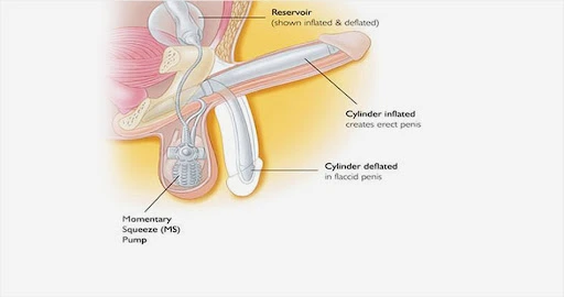 AD_4nXfRPNGGnmbWNBcKzcYBpGGFMI-IpTRCQX-tarwXTp_6sxiVWxmEXtmmu1RfPb8duOXRh0NDPWIF0q2kRmYj8KkphKH3DsYCl9SoHSub3kNZqxmqAqWxzHquQLSJvZie_RSft3Ev1g?key=-8AjFWwgeVs9wI9suWFA4g
