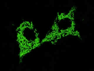 496431778_17913533421101533_7156488120144229867_n.jpg?stp=dst-jpg_e35_tt6&efg=eyJ2ZW5jb2RlX3RhZyI6InRocmVhZHMuQ0FST1VTRUxfSVRFTS5pbWFnZV91cmxnZW4uMzIweDI0MC5zZHIuZjc1NzYxLmRlZmF1bHRfaW1hZ2UifQ&_nc_ht=scontent-gmp1-1.cdninstagram.com&_nc_cat=101&_nc_oc=Q6cZ2QF2OEDoKmrf3Jr905alhRQpifgG4JWUQBi1wniAlEWW1YFYnGaAFT1SKBzNAGVkaZE&_nc_ohc=aDWFIFn394UQ7kNvwGciGUH&_nc_gid=VdFpgFDkpNcqsc6e5eyTyA&edm=ALvRx_oBAAAA&ccb=7-5&ig_cache_key=MzYyOTg1MTY5NzE1NDQ3NDkzNw%3D%3D.3-ccb7-5&oh=00_AfKZhm9nLZ-fS_YgH9IVrx6VmHs9hggZ9VImVQAXAgYwWQ&oe=6825D88E&_nc_sid=ecb15b