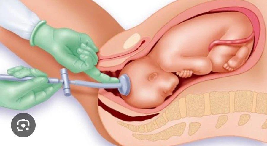 IMG_6944.jpg?type=w3840