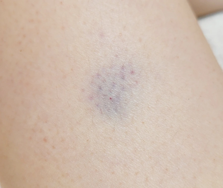 SE-d8ad9aca-54be-11ef-bf9b-79075a9a6935.jpg?type=w1