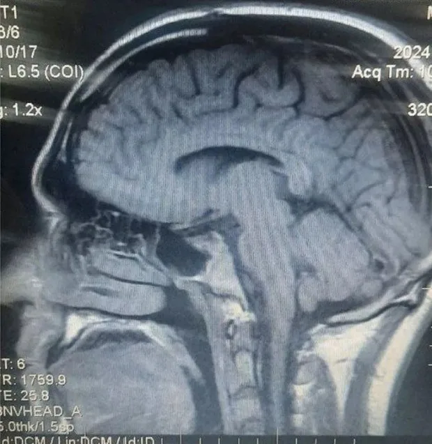 img.jpg?credential=yqXZFxpELC7KVnFOS48ylbz2pIh7yKj8&expires=1761922799&allow_ip=&allow_referer=&signature=aNllKqysIvM9ScJxm%2FCSPo74aqs%3D