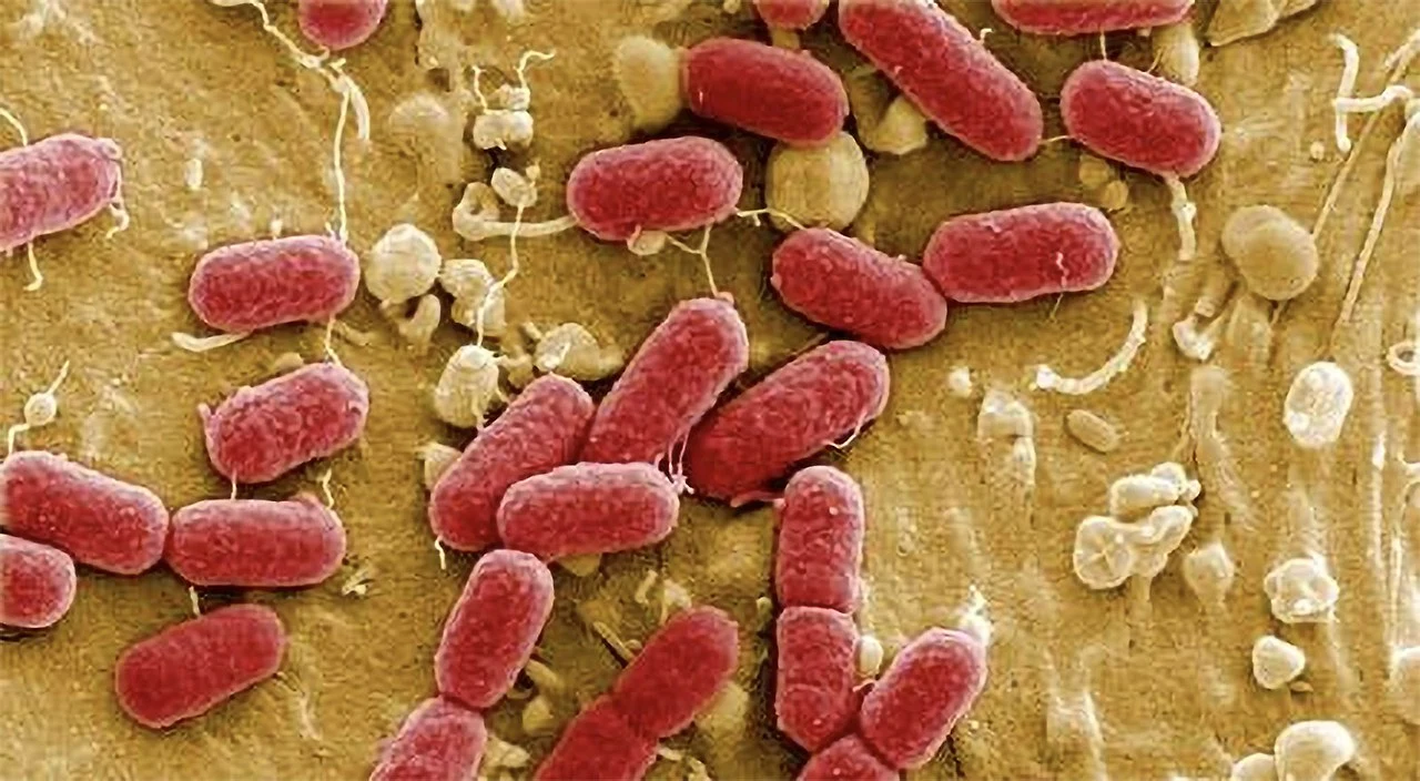 img.jpg?credential=yqXZFxpELC7KVnFOS48ylbz2pIh7yKj8&expires=1753973999&allow_ip=&allow_referer=&signature=DwcYn190ipwDA5LUwxaptiYYNtU%3D