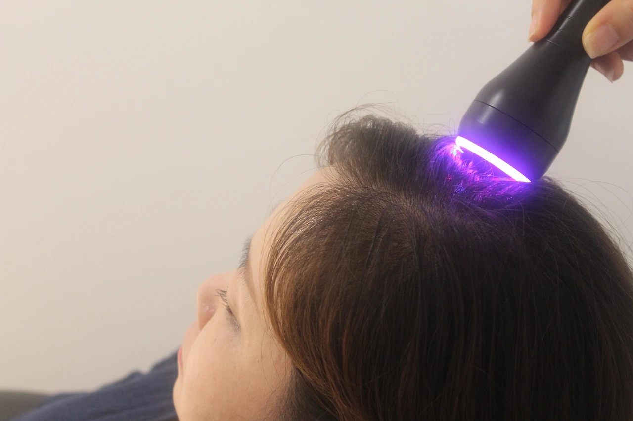 부산 비듬원인.JPG