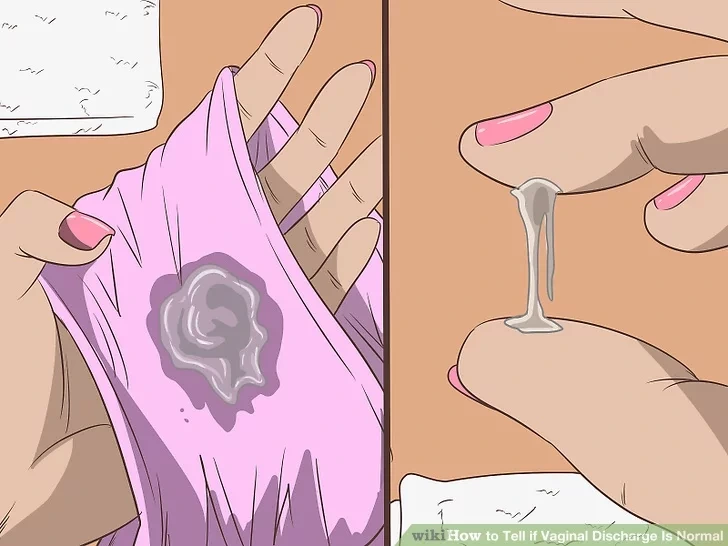 aid4733464-v4-728px-Tell-if-Vaginal-Discharge-Is-Normal-Step-2-Version-2.jpg.jfif