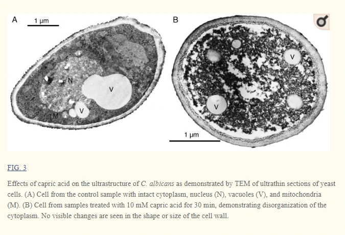 지방산의 칸디다 제거 효과.PNG